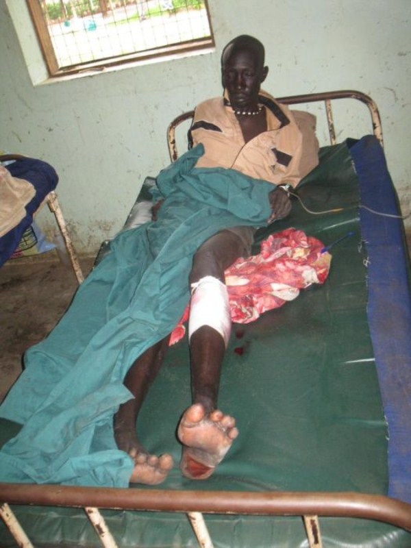 2175 Horrible Prison in South Sudan (30 photos)