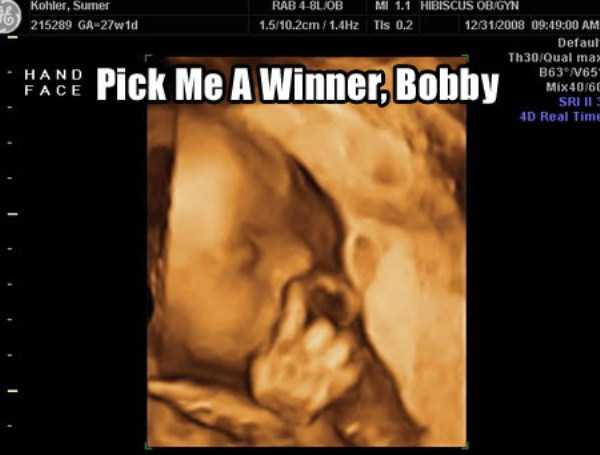 funny-ultrasound-photos (17)