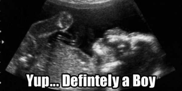 Funny Things Detected by Ultrasound (20 photos) 