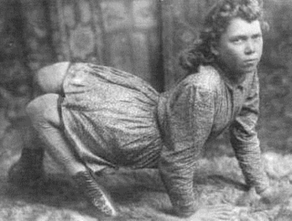 Circus Freaks of the Past (21 photos)