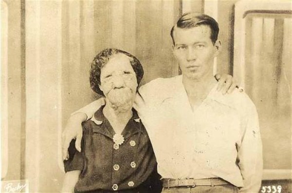 Circus Freaks of the Past (21 photos)