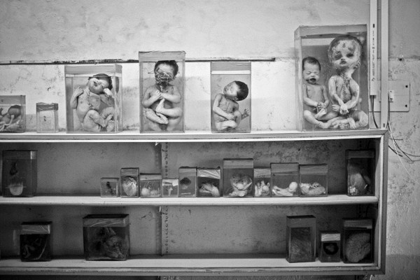 Bhopal Gas Tragedy: 28 Years on (12 photos)