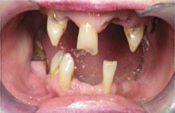 Meth Mouth (17 photos)
