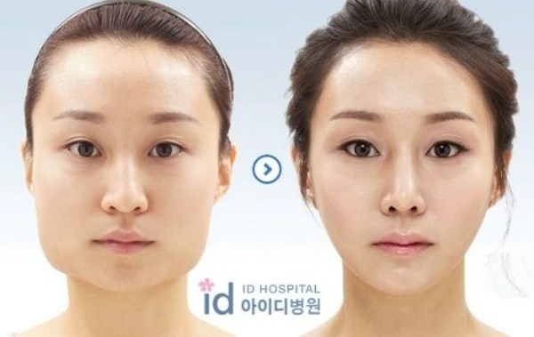 Plastic Surgery in South Korea (31 photos)