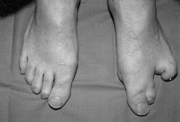 Deformities and Genetic Mutations (32 photos)
