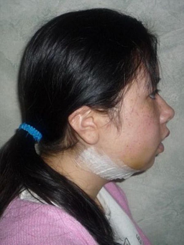 Face Surgery (16 photos)
