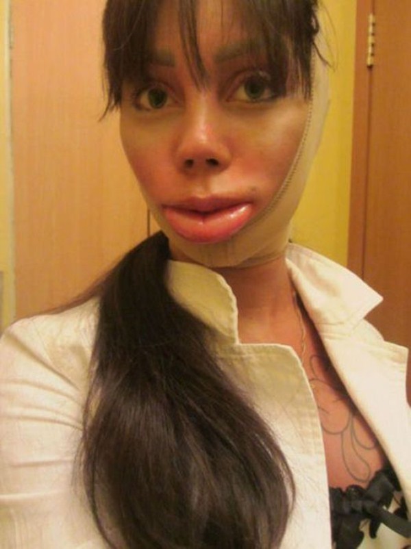 Plastic Surgery Disaster (51 photos)