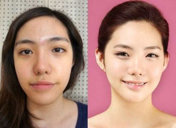 Young Koreans Before and After Plastic Surgery (62 photos)