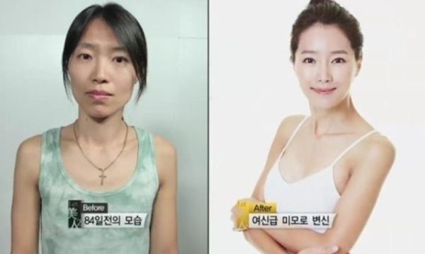 Young Koreans Before and After Plastic Surgery (62 photos)