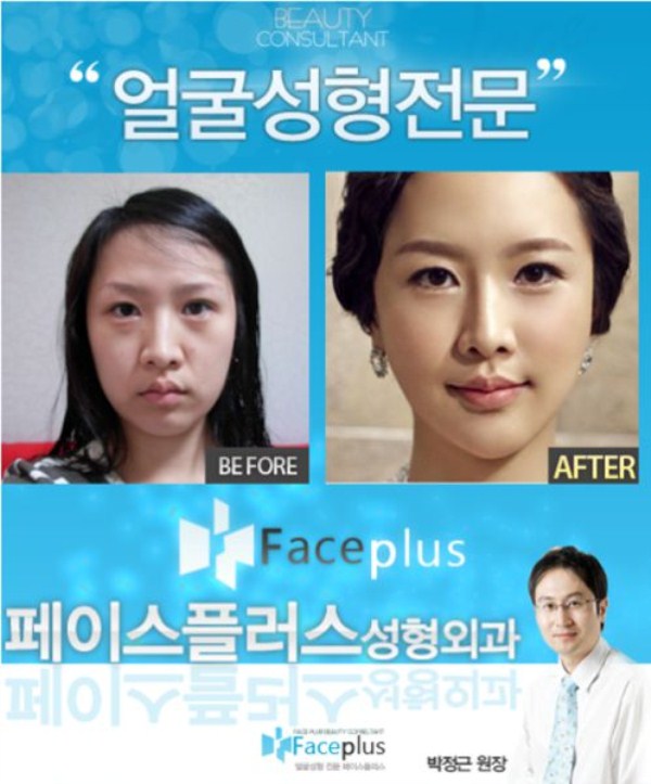 Young Koreans Before and After Plastic Surgery (62 photos)