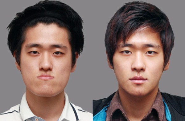 Young Koreans Before and After Plastic Surgery (62 photos)