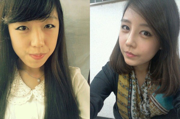 Young Koreans Before and After Plastic Surgery (62 photos)