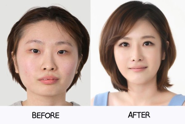 Young Koreans Before and After Plastic Surgery (62 photos)