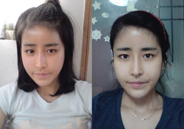 Young Koreans Before and After Plastic Surgery (62 photos)