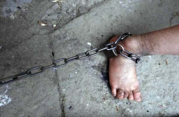 Mentally Ill Boy Chained Up Like a Dog (10 photos) 5