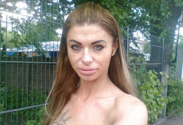 The Obvious Overuse of Plastic Surgery (25 photos)