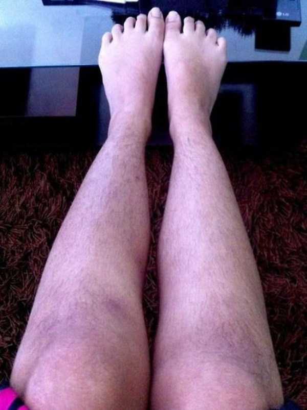 Women With Hairy Legs (25 photos)
