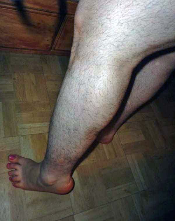 Women With Hairy Legs (25 photos)