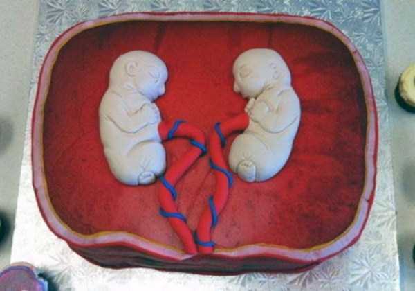 birth cakes 10
