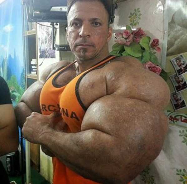 Terrible Overuse of Synthol (20 photos)