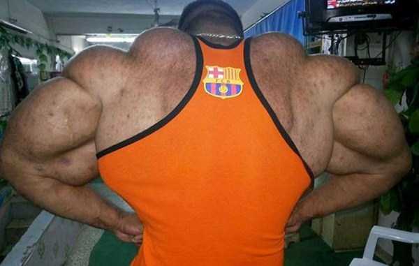 Terrible Overuse of Synthol (20 photos) 15