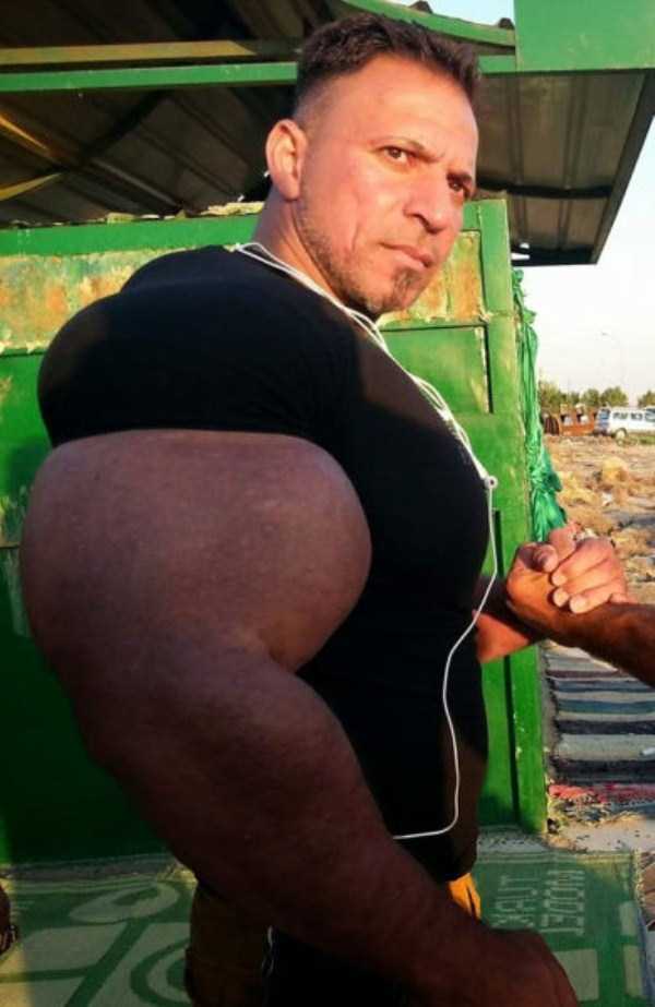 Terrible Overuse of Synthol (20 photos)