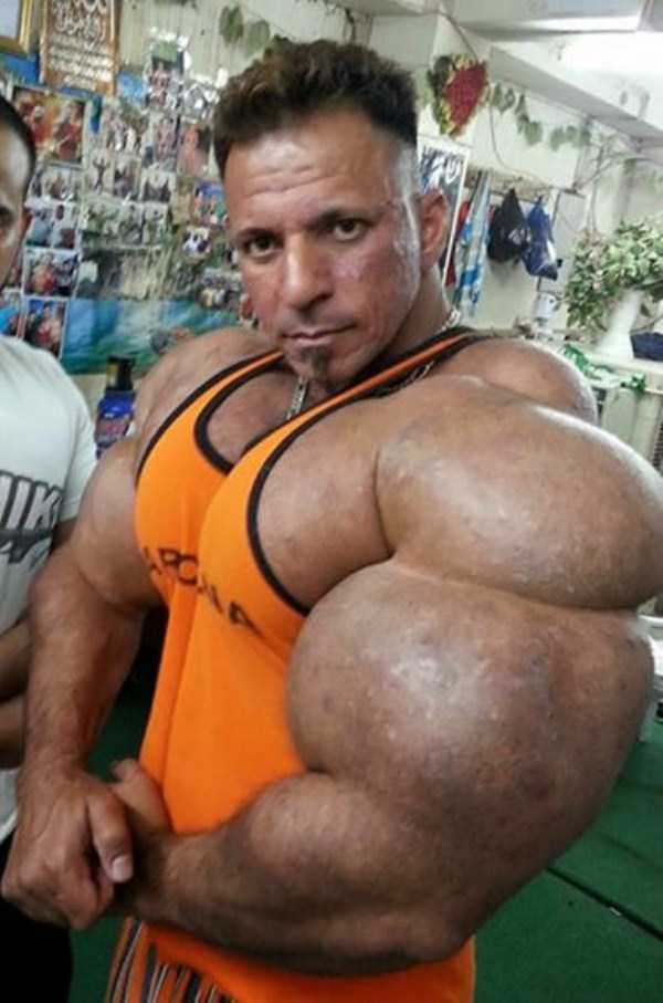 this guy uses way too much synthol 6