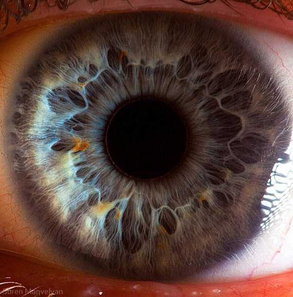 Human Eye Under a Microscope (21 photos)