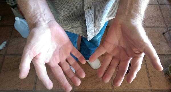 A Man With Extra Fingers (3 photos)
