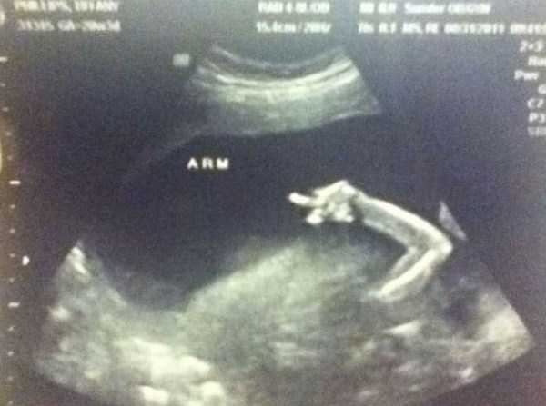 funny ultrasound photos 12