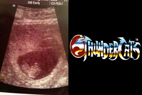 funny ultrasound photos 18