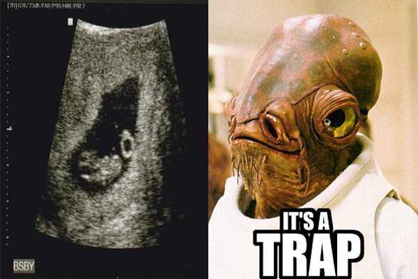 Funny Things Detected by Ultrasound (20 photos)