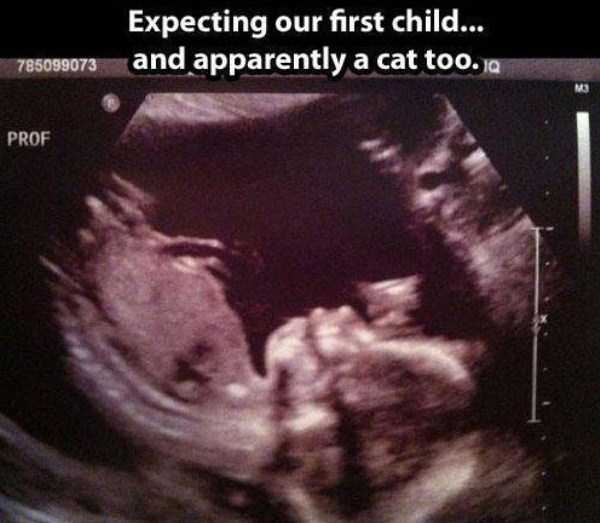 funny ultrasound photos 4