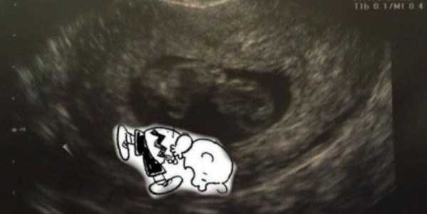 funny ultrasound photos 5