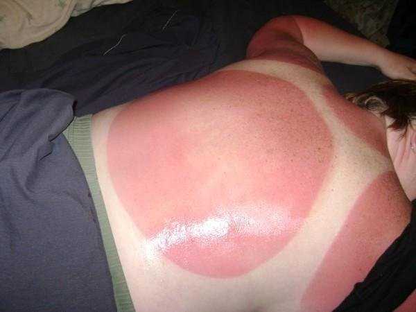 OMG, That Must Have Hurt Like Hell (41 photos)