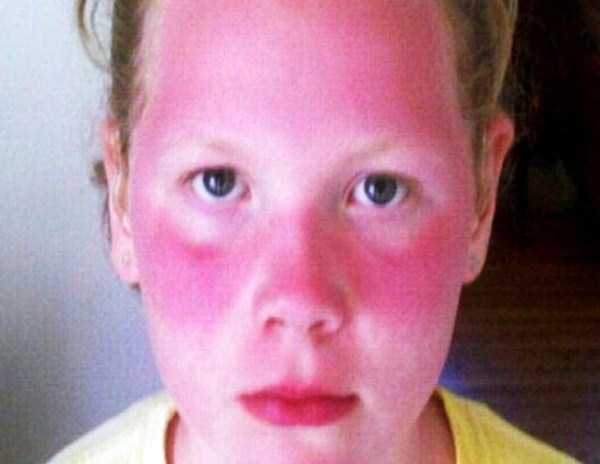 OMG, That Must Have Hurt Like Hell (41 photos)