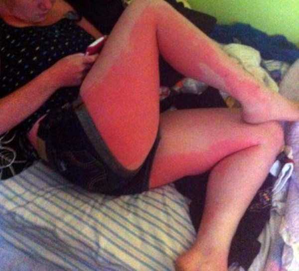 OMG, That Must Have Hurt Like Hell (41 photos)