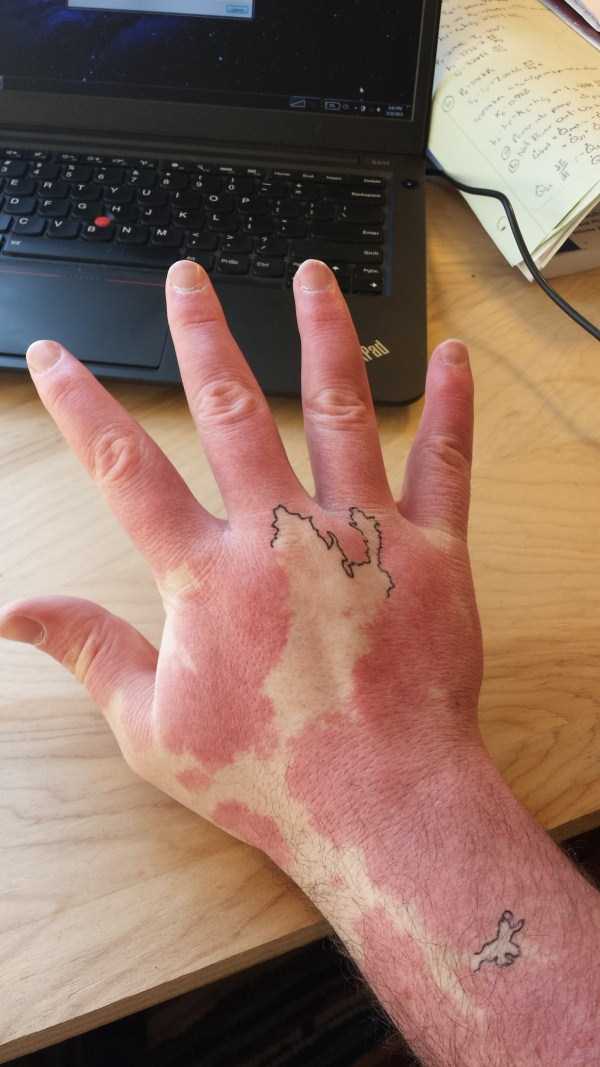 Creative Guy Turns His Birthmarks Into a Unique Map (19 photos)