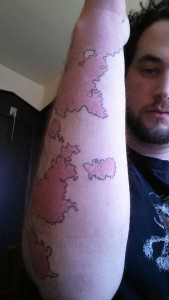 Creative Guy Turns His Birthmarks Into a Unique Map (19 photos) 10