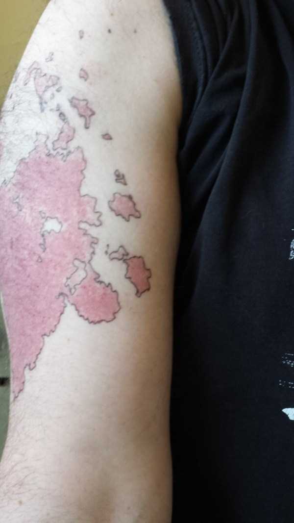 Creative Guy Turns His Birthmarks Into a Unique Map (19 photos)