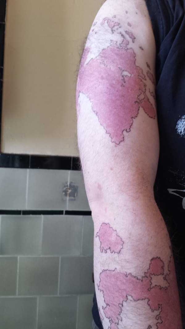 Creative Guy Turns His Birthmarks Into a Unique Map (19 photos)