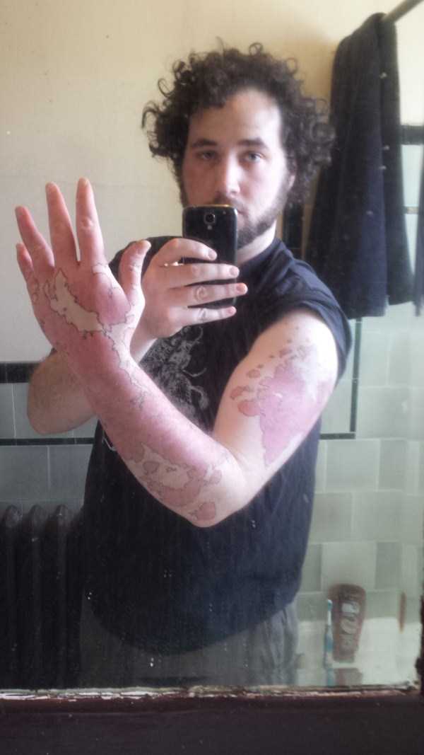 Creative Guy Turns His Birthmarks Into a Unique Map (19 photos)