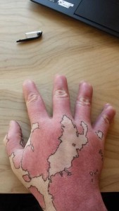 Creative Guy Turns His Birthmarks Into a Unique Map (19 photos) 3