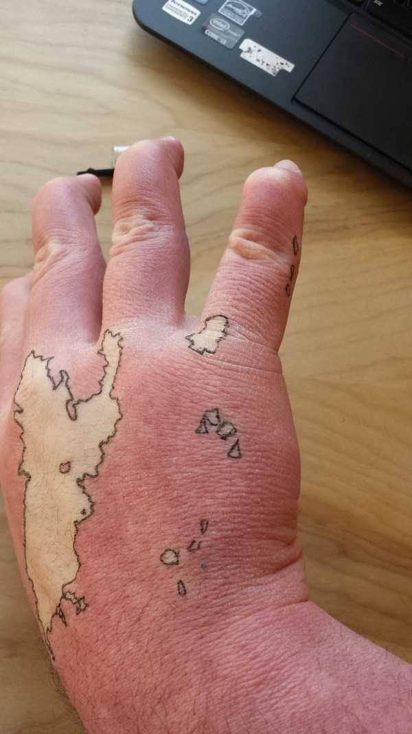 Creative Guy Turns His Birthmarks Into a Unique Map (19 photos)