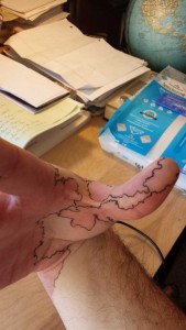 Creative Guy Turns His Birthmarks Into a Unique Map (19 photos) 7