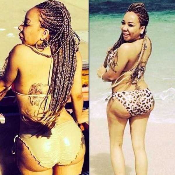 fake butts implants 18 These Butts Are So Awfully Fake (24 photos)