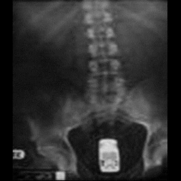 Bizarre Objects Found in Peoples Butts (27 photos)
