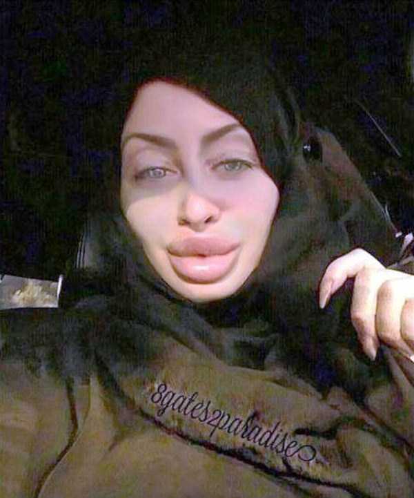 The Largest Lips of Instagram (11 photos)
