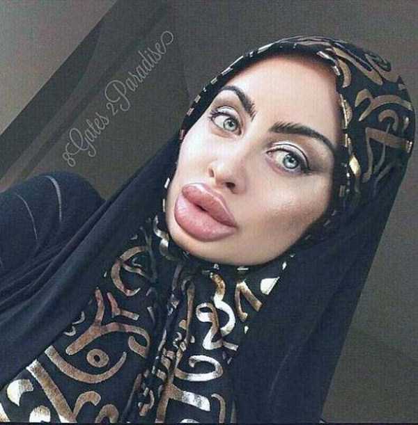 The Largest Lips of Instagram (11 photos)