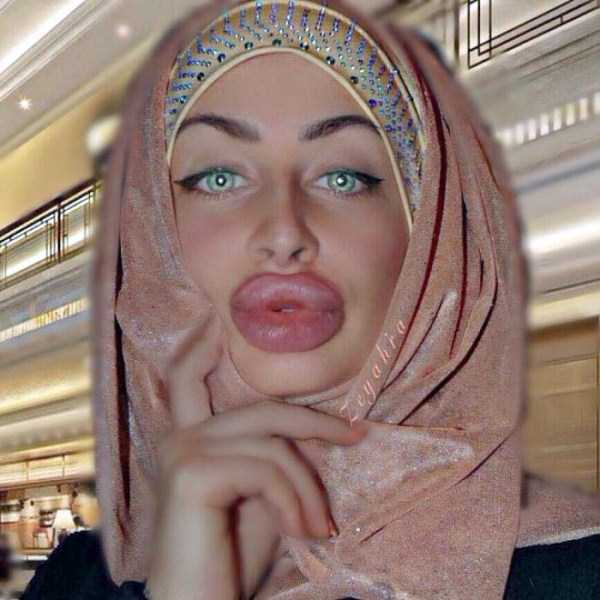 The Largest Lips of Instagram (11 photos)